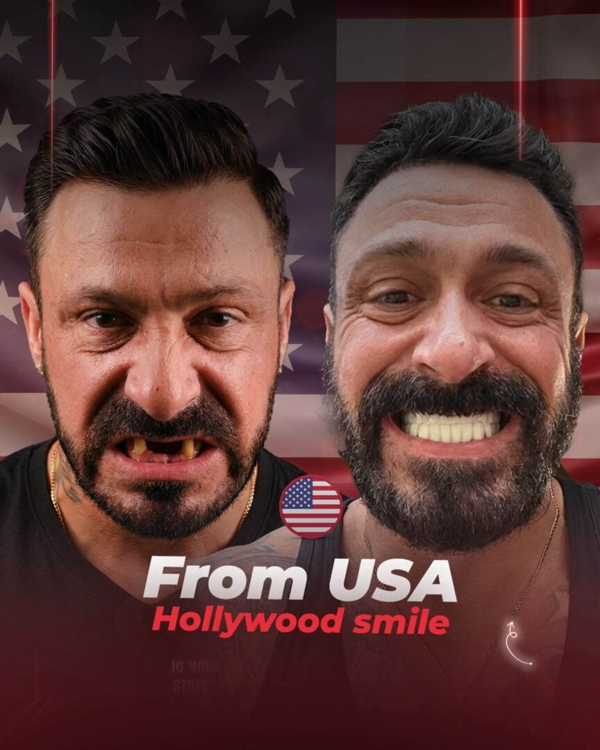 Hollywood Smile by the Estherian Clinic