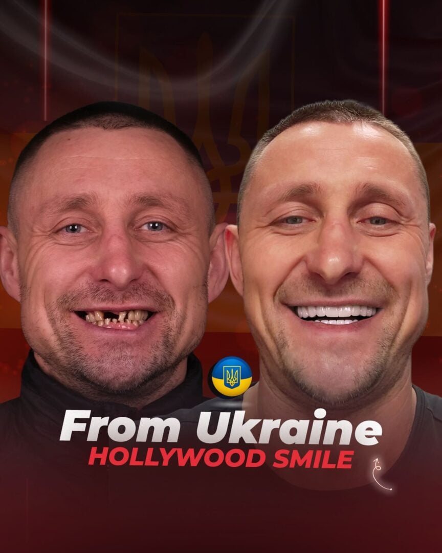 Estherian Kliniği tarafından sunulan Hollywood Gülüşü