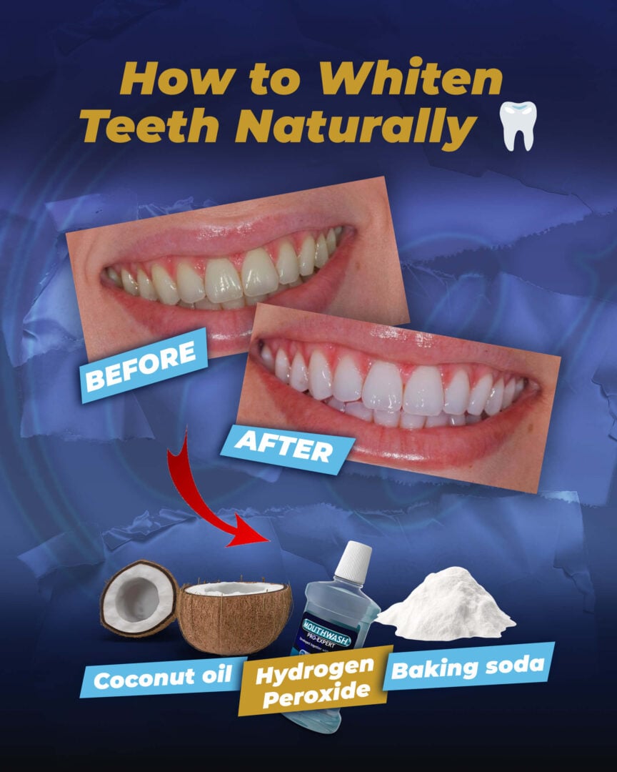 How-to-Whiten-Teeth-Naturally