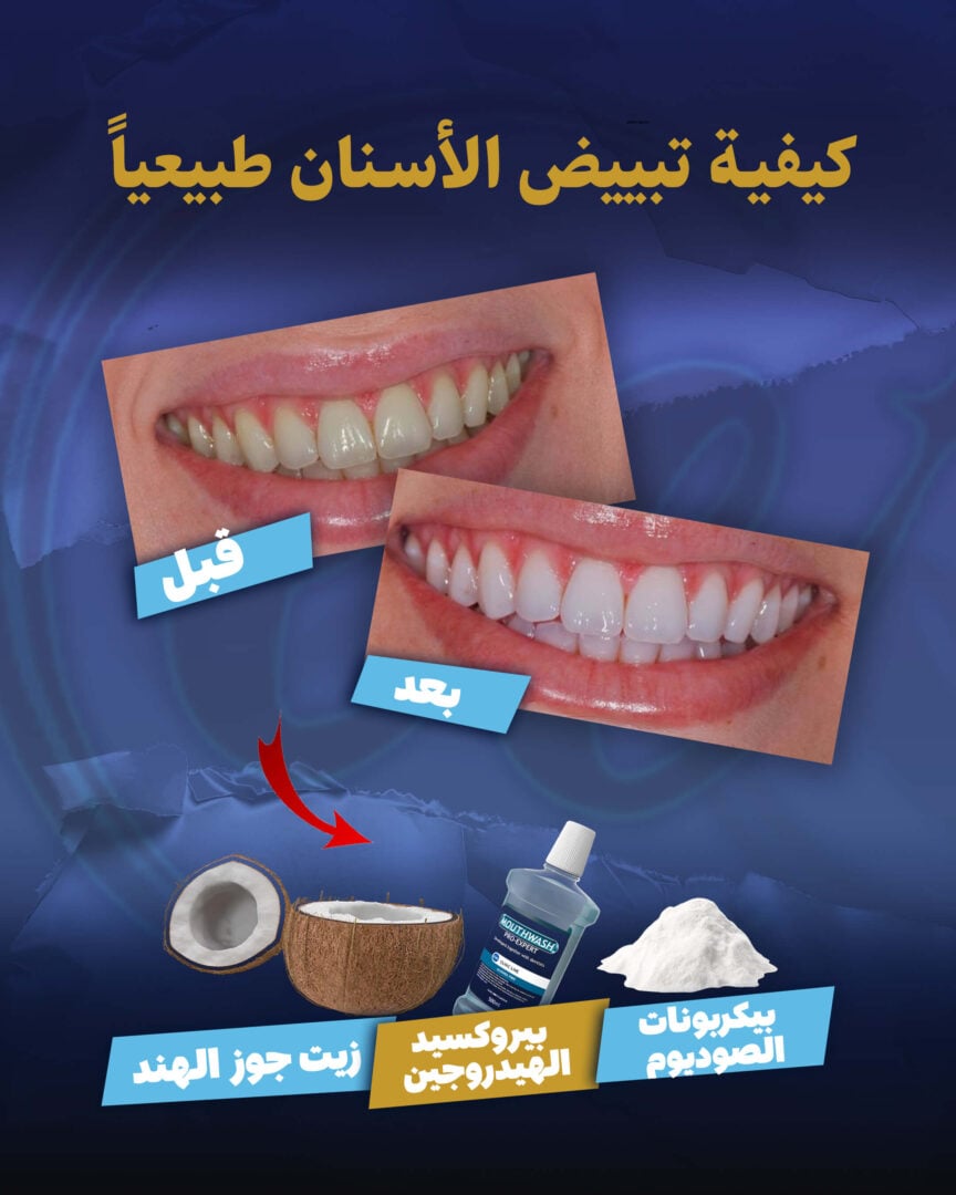 كيفية تبييض الأسنان طبيعياً