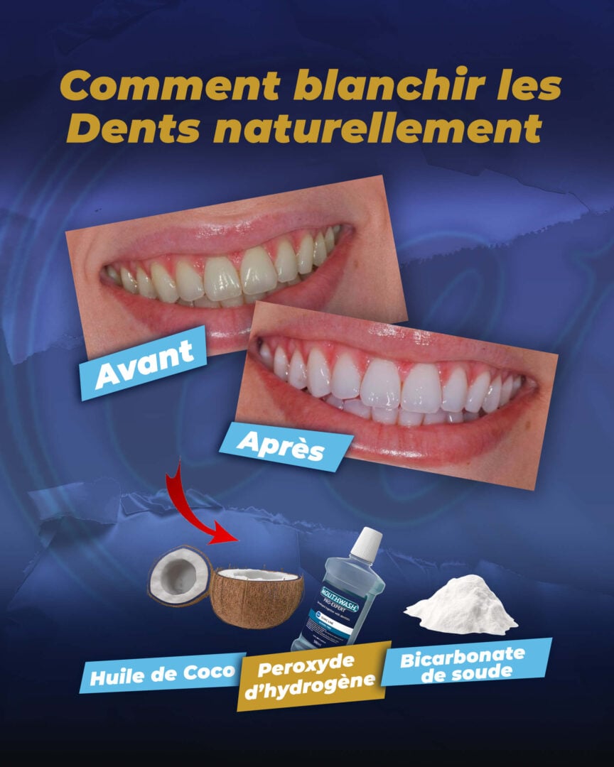 Comment blanchir ses dents naturellement