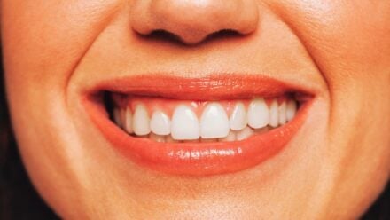 How to whiten teeth naturally