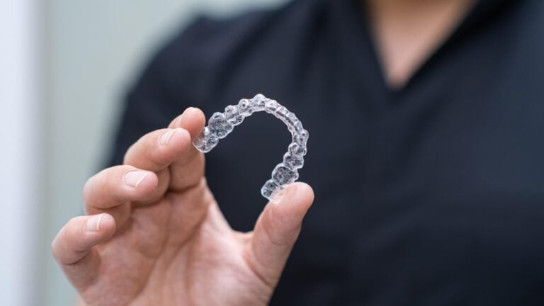 Invisalign Vs Braces