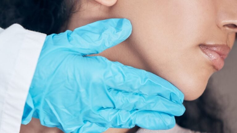 Under Chin Fat Removal Explore the Techniques