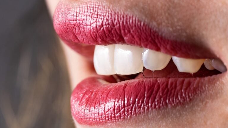 All About the Maintenance of Veneers