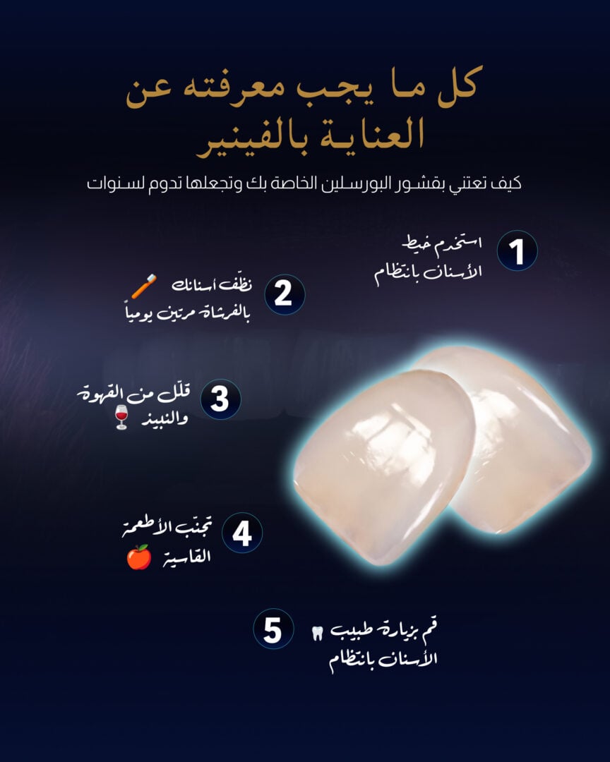 صيانة قشور الأسنان (دليل من عيادة إستيريان)