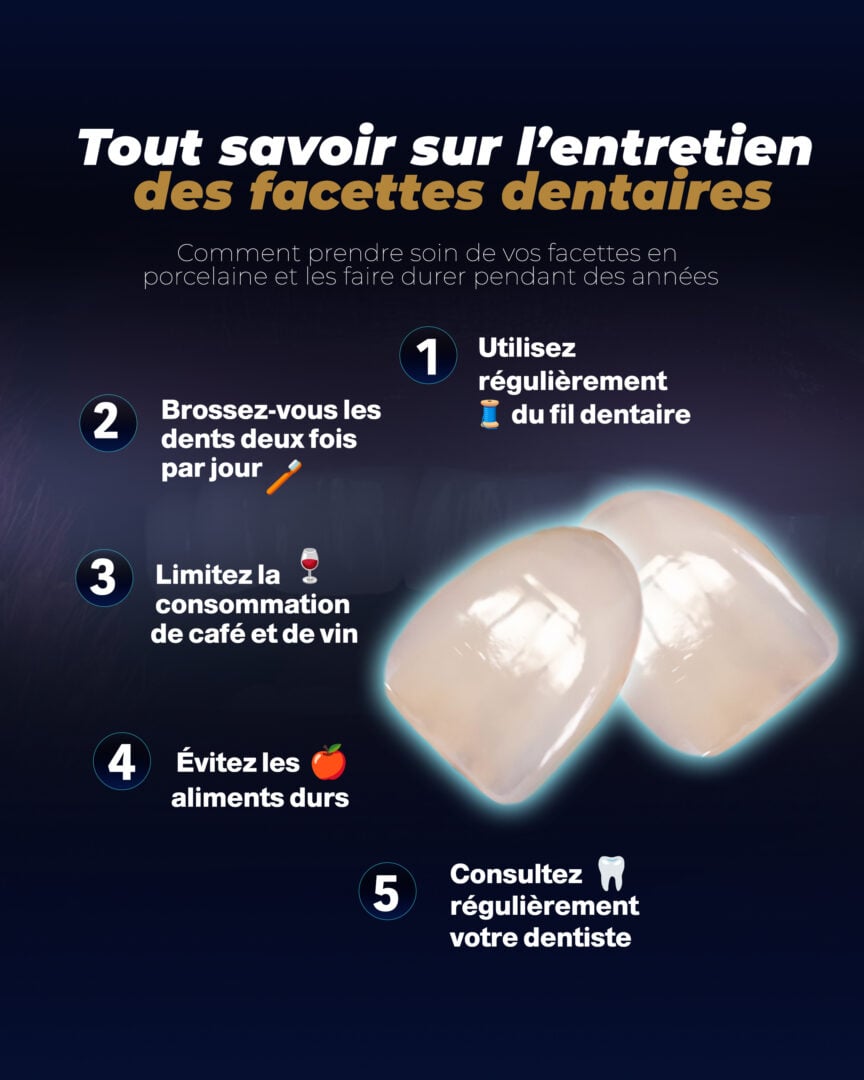 Entretien des facettes dentaires (Guide de la clinique Estherian)