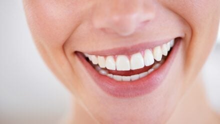 Hollywood Smile Consultation Guide