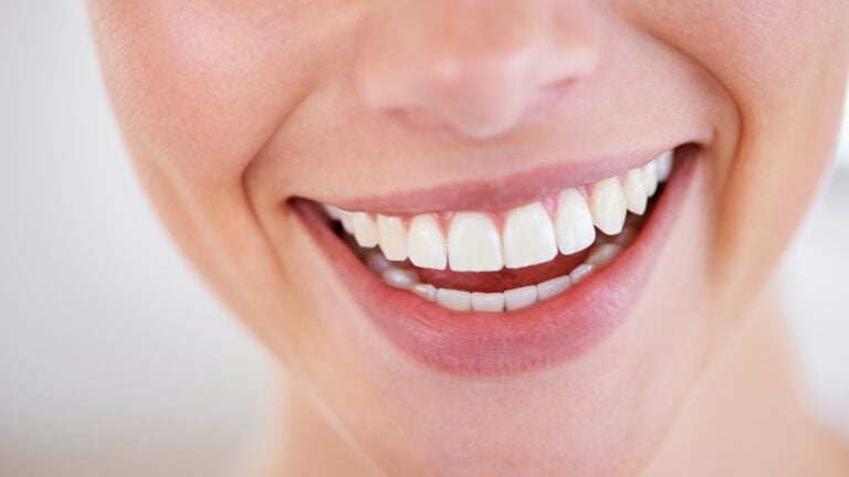 Hollywood Smile Consultation Guide