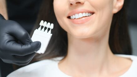 How to Remove Brown Stains from Teeth Naturally