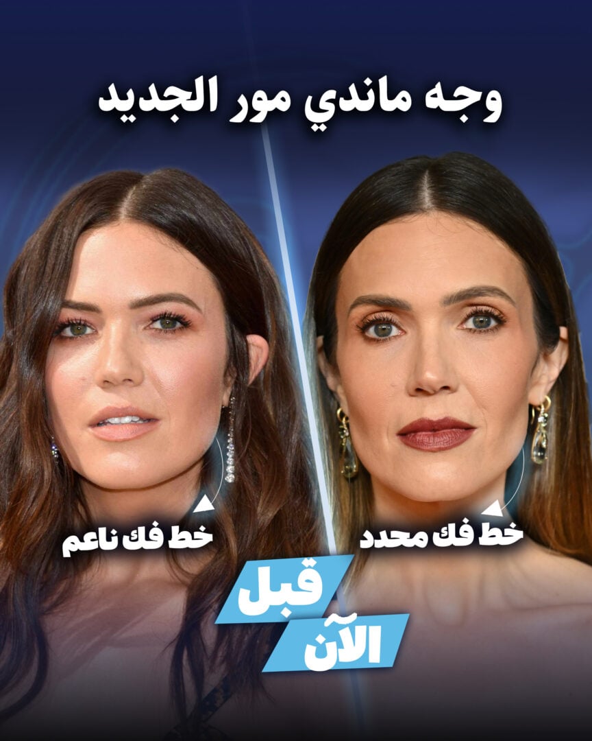 ماندي مور قبل وبعد تغيير لون بشرتها