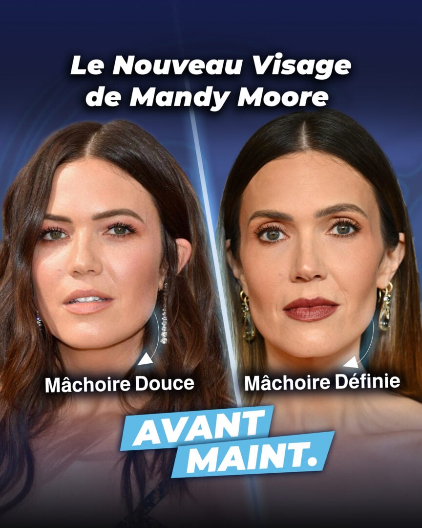 Le visage de Mandy Moore avant et après