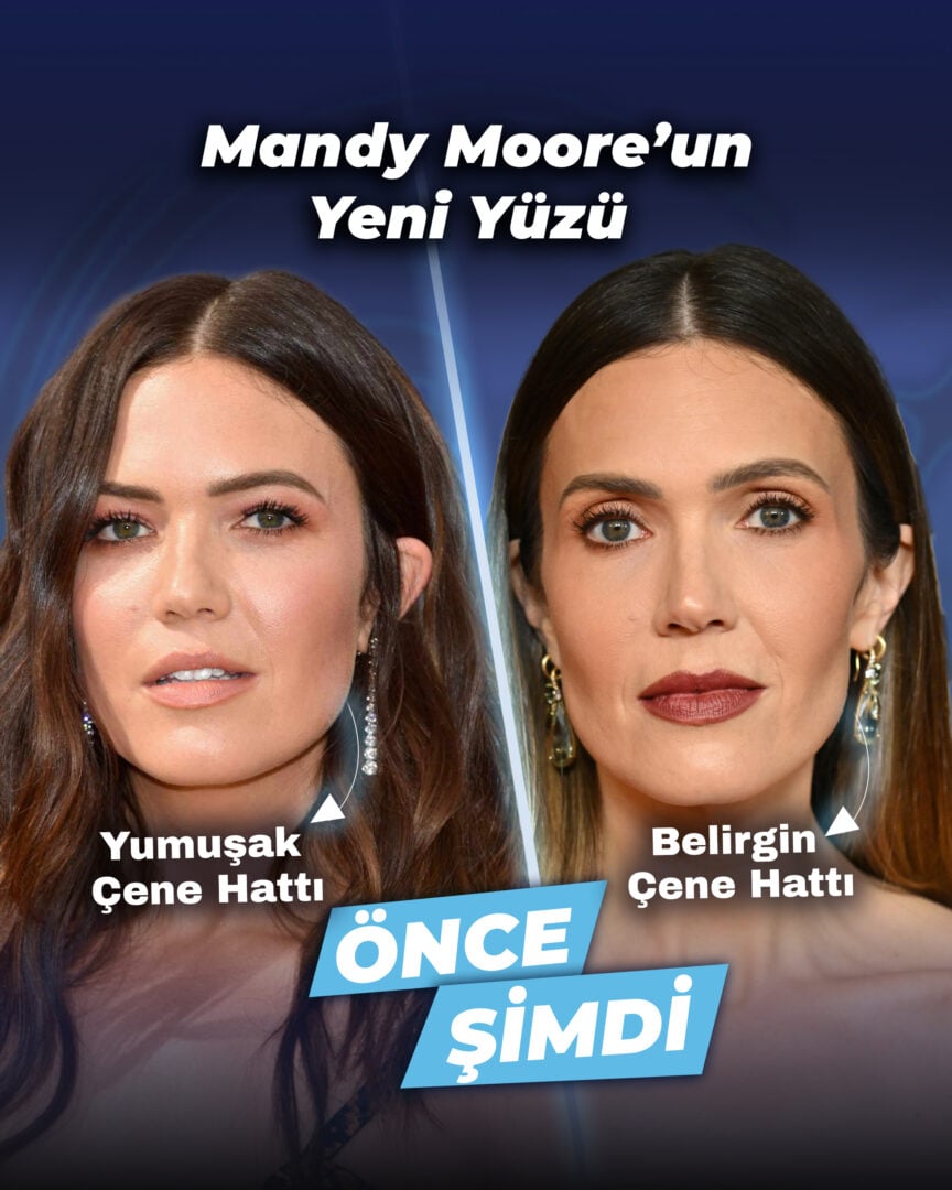 Mandy Moore'un önceki ve sonraki yüz fotoğrafları.