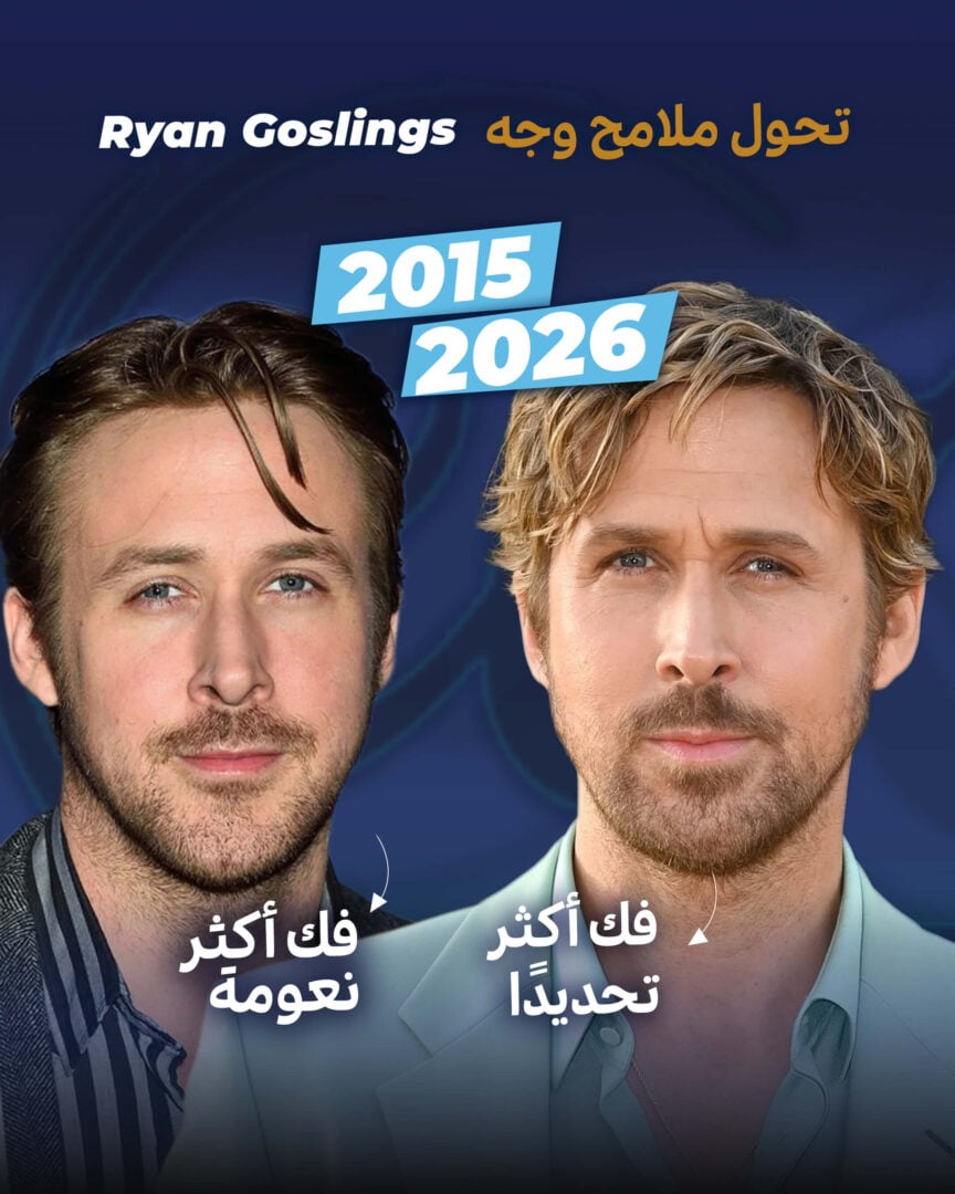 تحوّل وجه ريان غوسلينغ (قبل وبعد)
