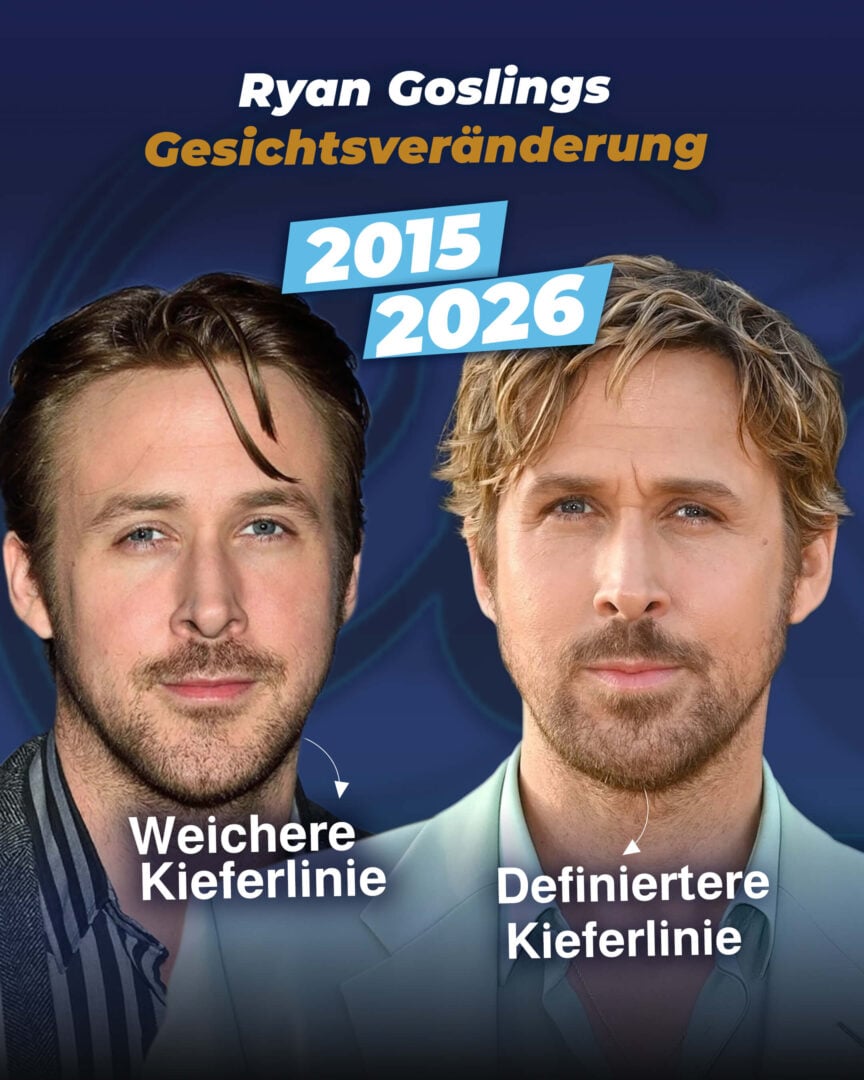Ryan Goslings Gesichtsverwandlung – Estherian (vorher und nachher)