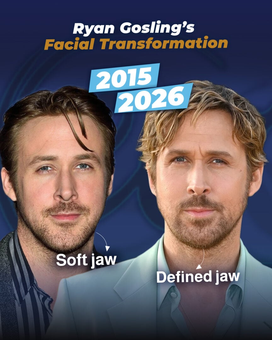 Ryan-Gosling’s-Facial-Transformation-estherian (before and after)