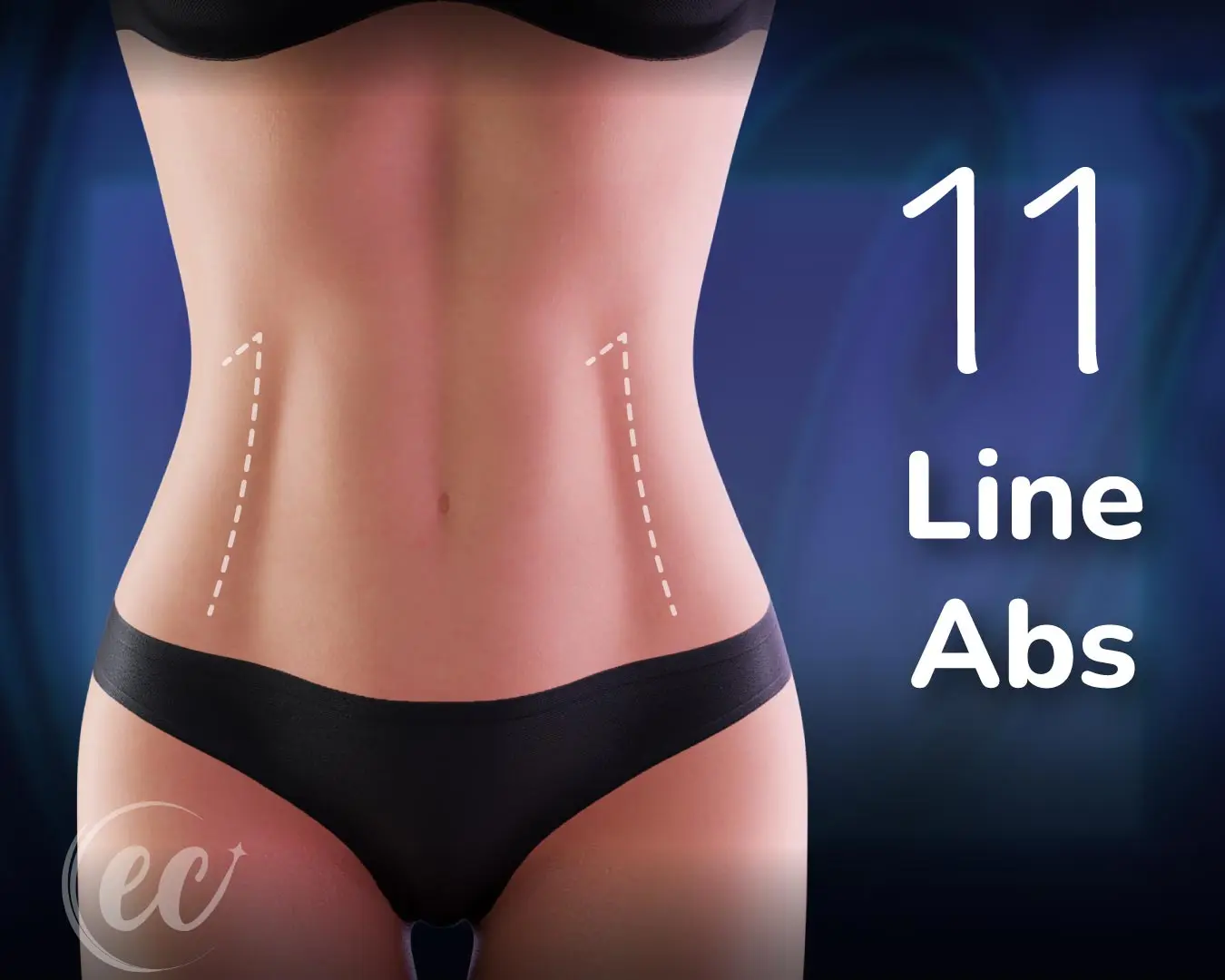 Abdos 11 Lignes - Abdos Two-pack