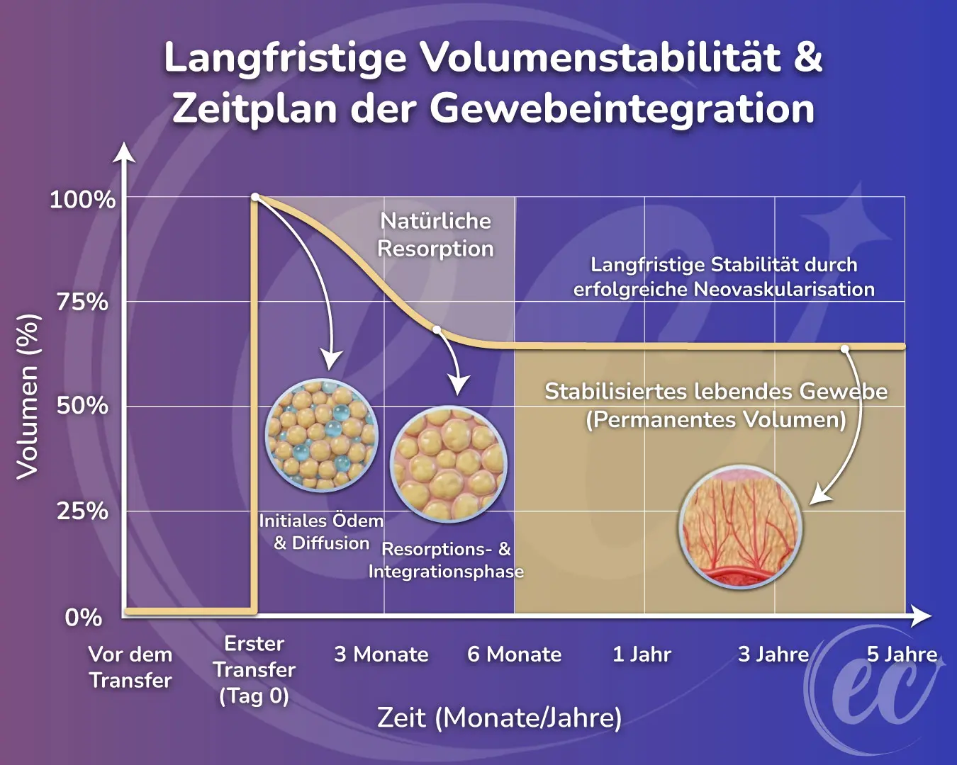 Langzeitverlauf der Volumenstabilität und Gewebeintegration nach Brustfetttransfer nach 5 Jahren