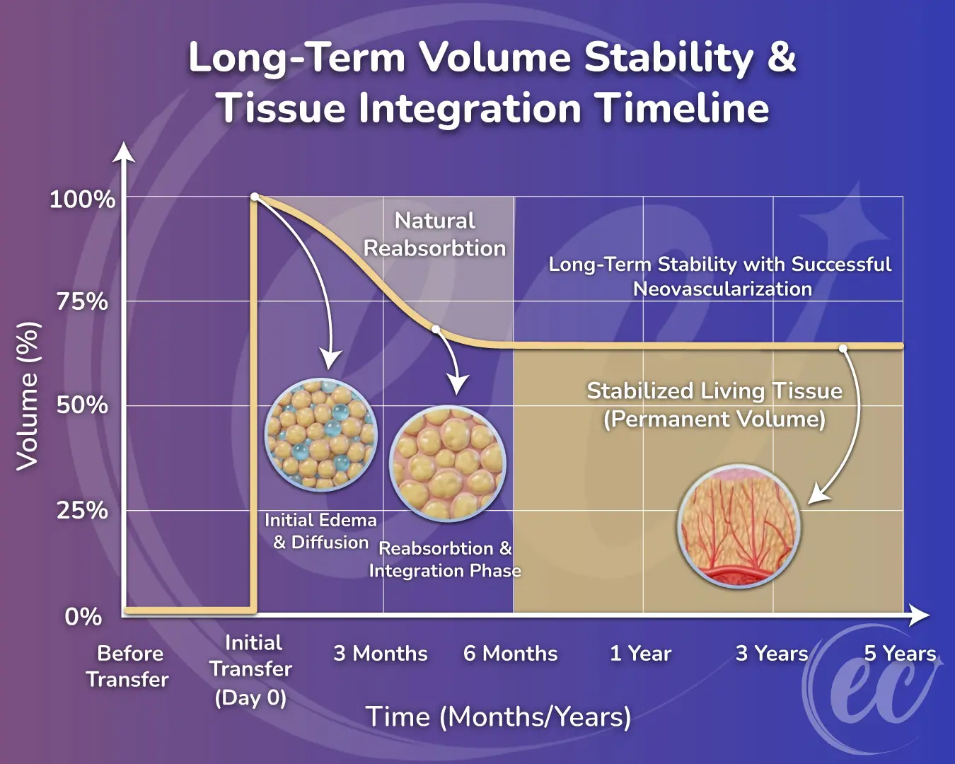 Long-Term-Volume-Stability-&-Tissue-Integration-Timeline-Breast Fat Transfer Results After 5 Years.jpg
