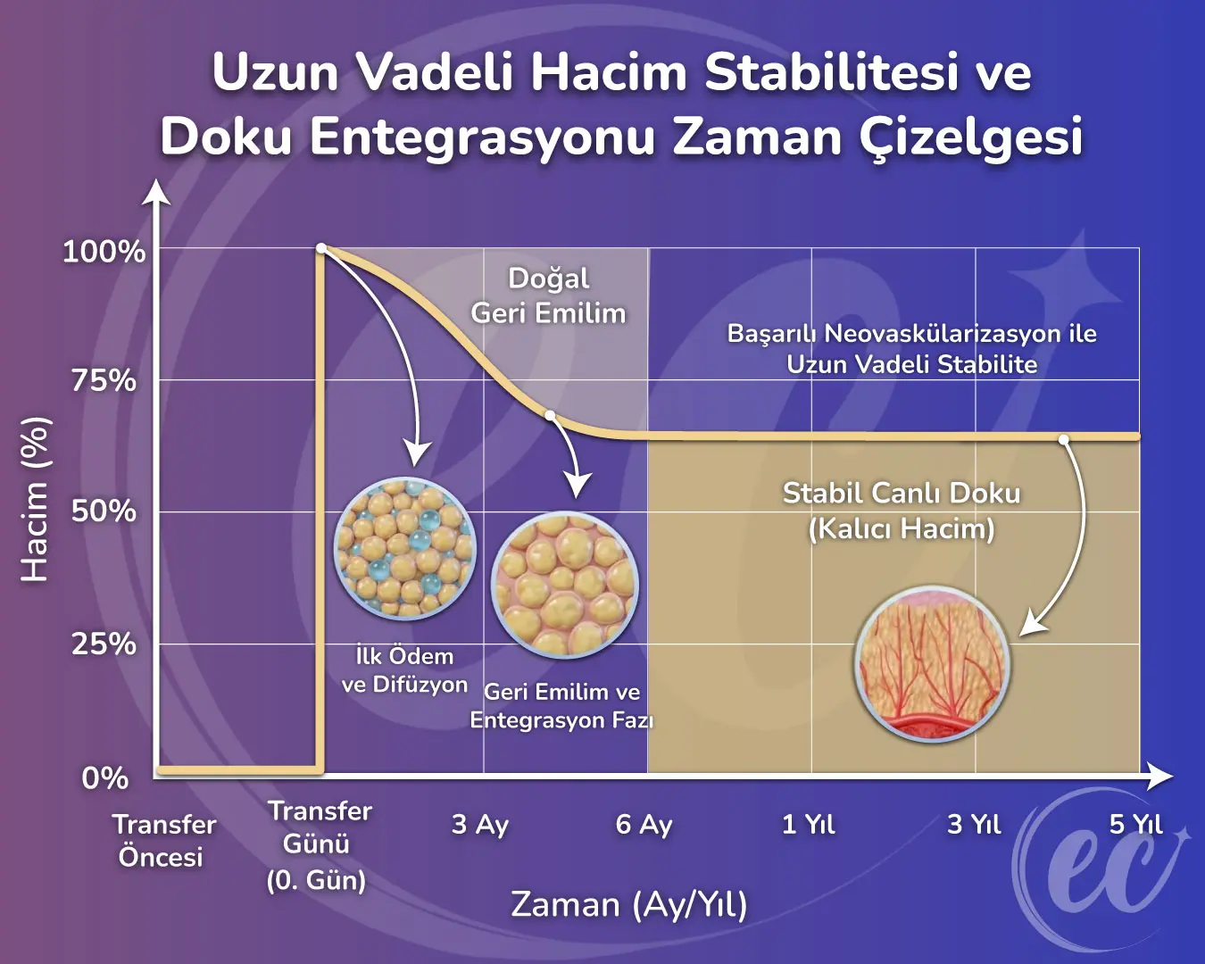 Uzun Vadeli Hacim İstikrarı ve Doku Bütünleşmesi Zaman Çizelgesi - 5 Yıl Sonra Meme Yağ Transferi Sonuçları.jpg