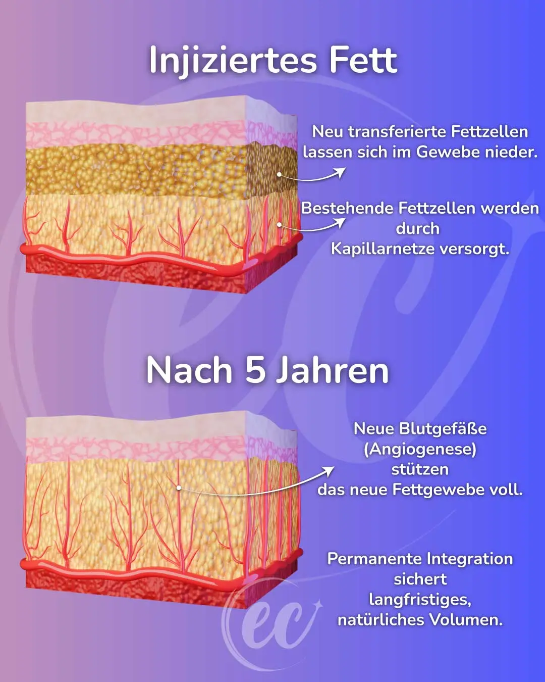 Infografik: Neue Fettzellen nach fünf Jahren