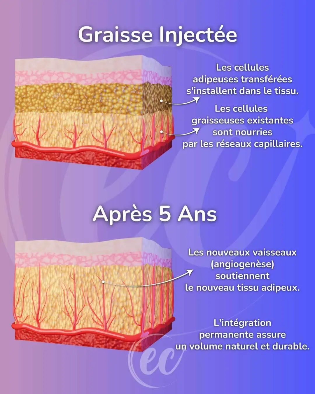 Nouvelles cellules adipeuses après cinq ans - Infographie - Fr