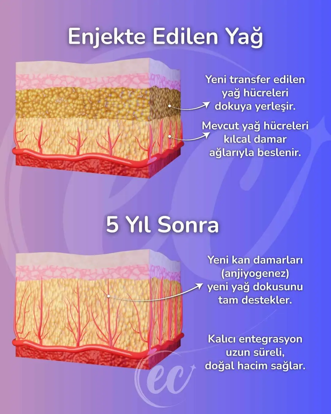 Beş Yıl Sonra Oluşan Yeni Yağ Hücreleri Bilgi Grafiği
