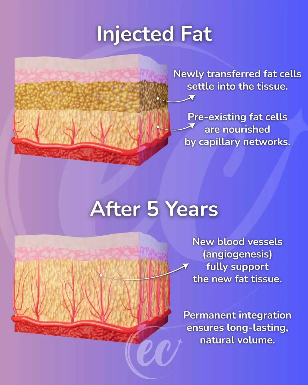 New-Fat-Cells-After-Five-Years-Infographic