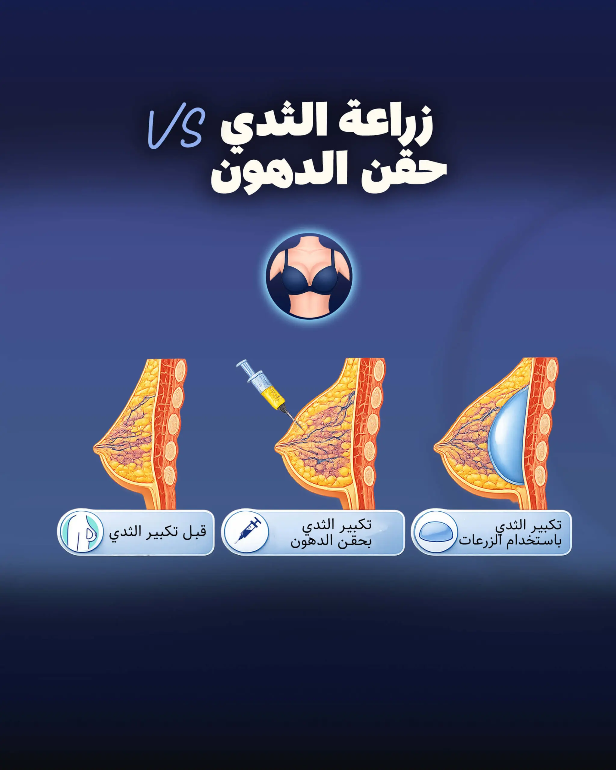 زراعة الثدي مقابل نقل الدهون