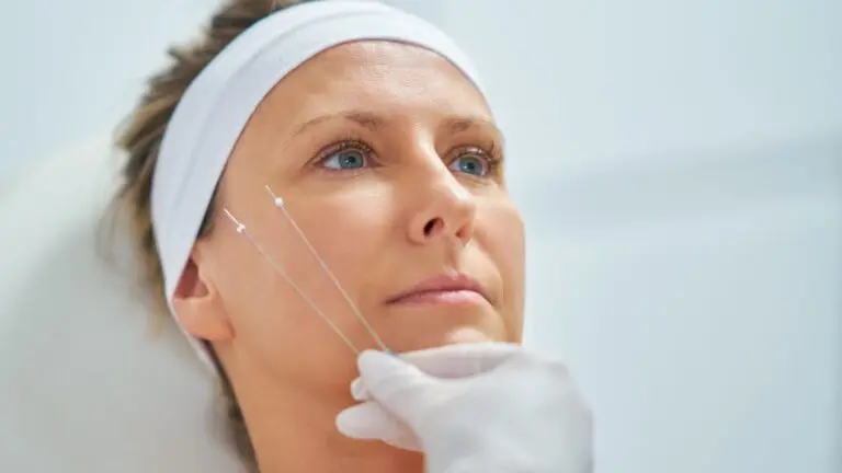 What Is a Thread Face Lift and How Does It Compare to Surgery