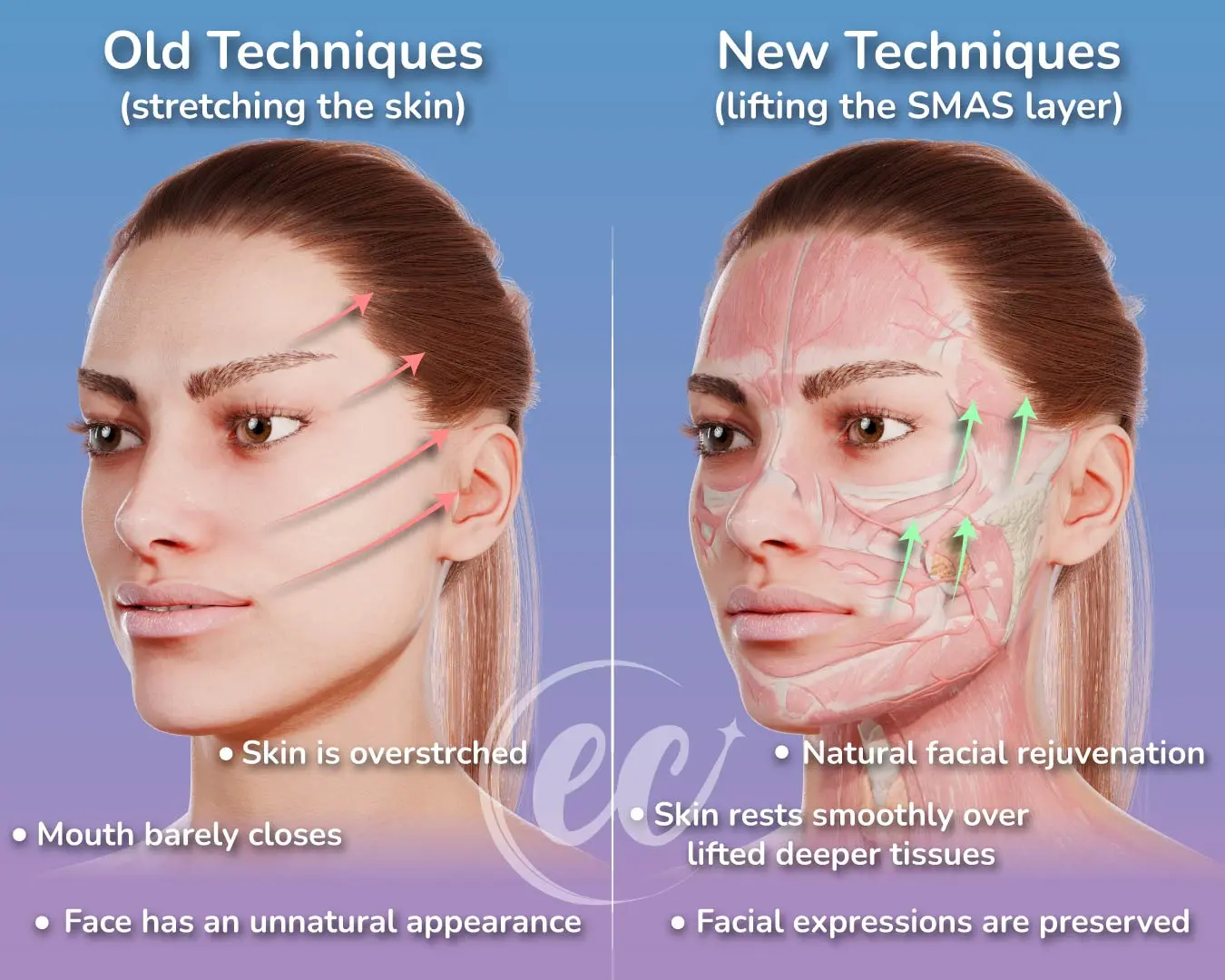 "Prices vary if you combine your treatment with other procedures, such as eyelid surgery or brow lifts.
