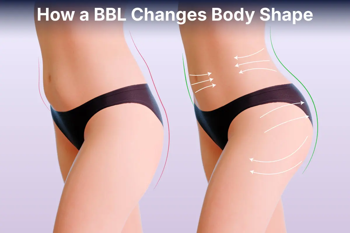 Full medical guide to BBL surgery