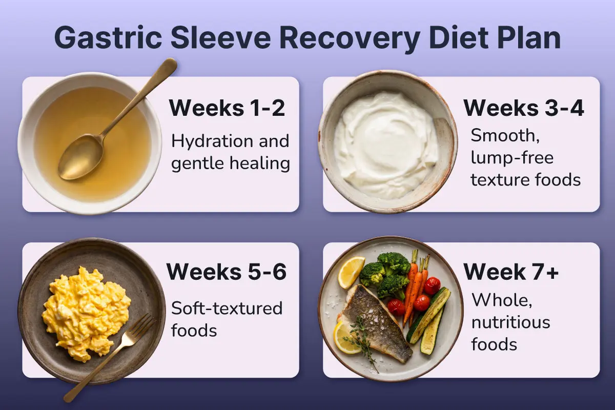 Aftercare and Recovery for Gastric Sleeve Surgery