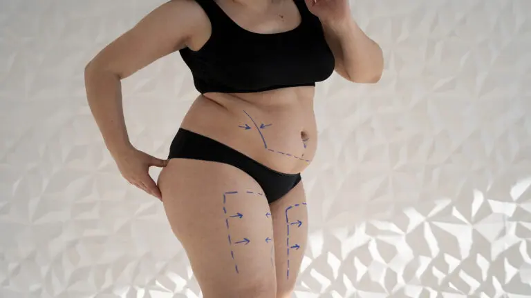 Liposuction Cost Turkey