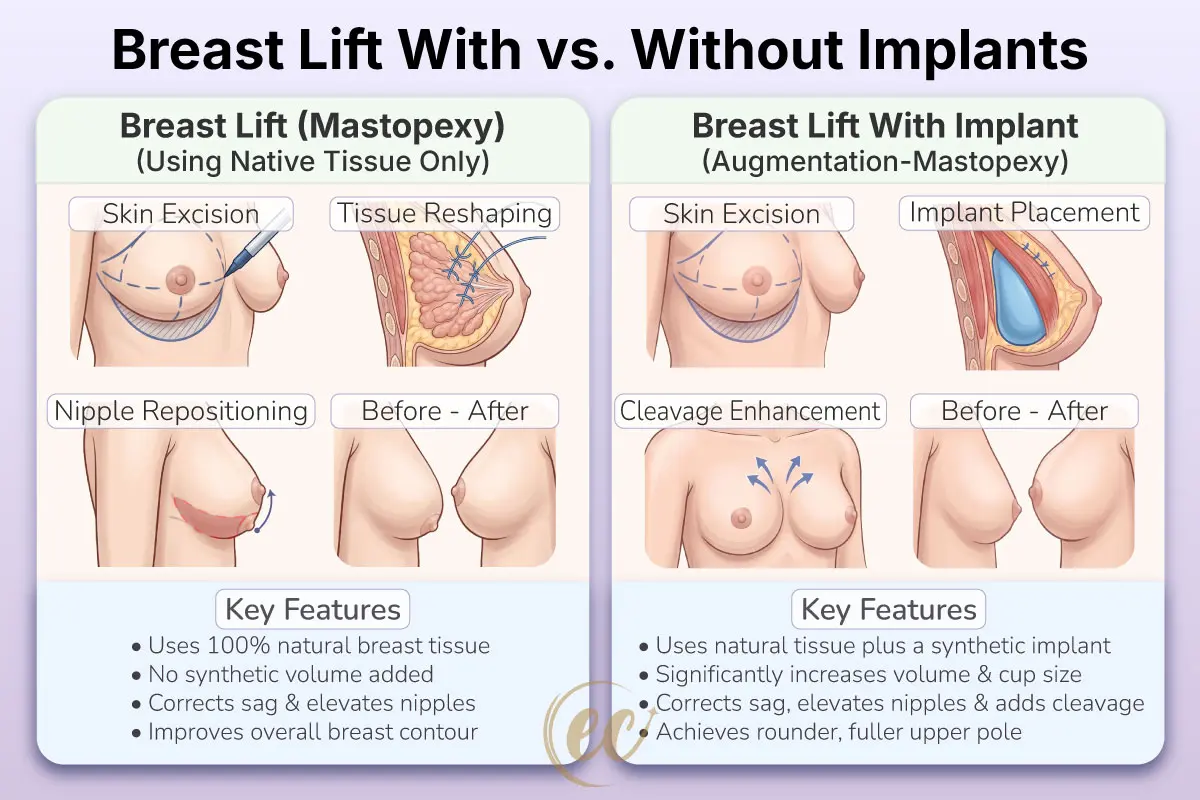 Breast Lift With vs. Without-Implant