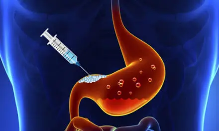 Is Gastric Botox FDA Approved?