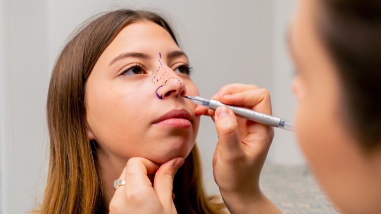Long-term effects rhinoplasty