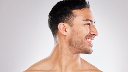 Male Rhinoplasty