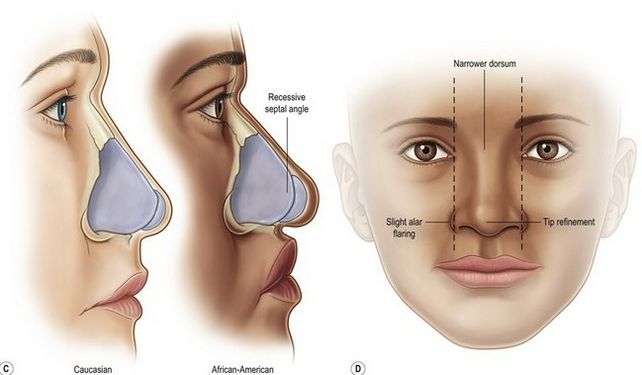 Anatomical Differences Across Ethnic Groups