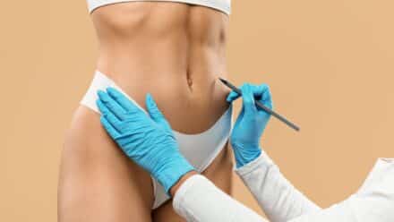 Post-Liposuction Recovery Estherian's Specialized Massage Therapy Approach