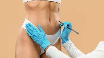 Post-Liposuction Recovery Estherian's Specialized Massage Therapy Approach