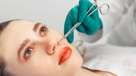types of rhinoplasty guide