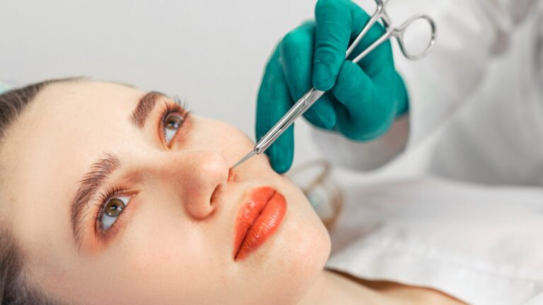 types of rhinoplasty guide
